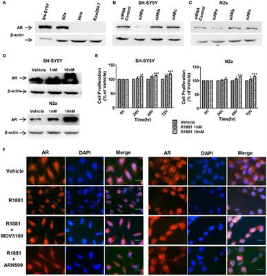 Androgen Receptor Regulates the Growth of Neuroblastoma Cells in vitro and in vivo